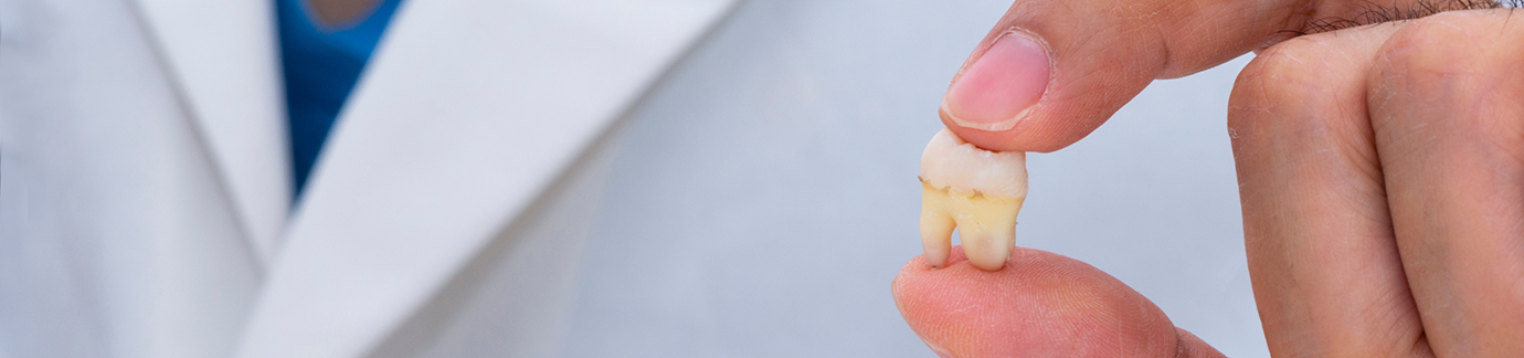 Holding tooth between fingers after tooth extraction in Frisco