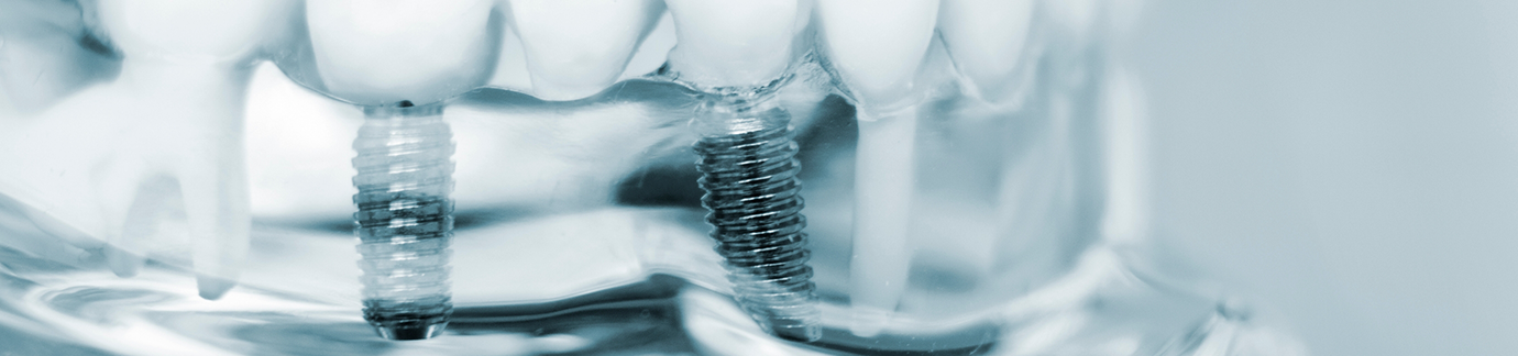 Close up of dental implant in plastic model of mouth