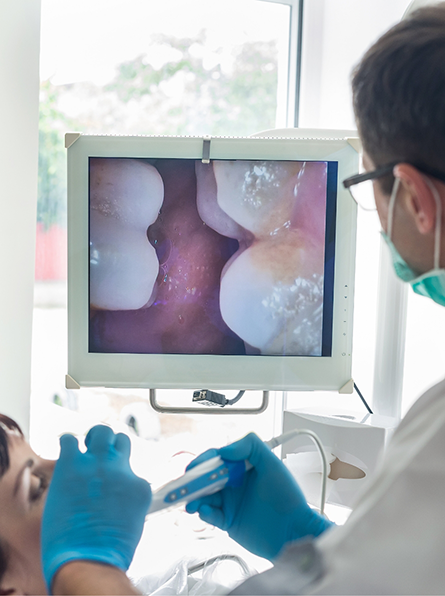 Checking patient's teeth with intraoral camera