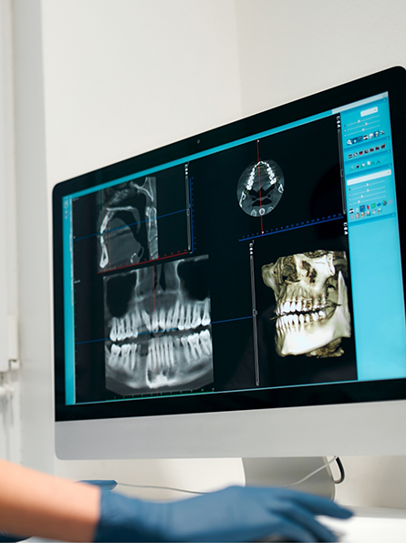 Checking dental X rays on monitor