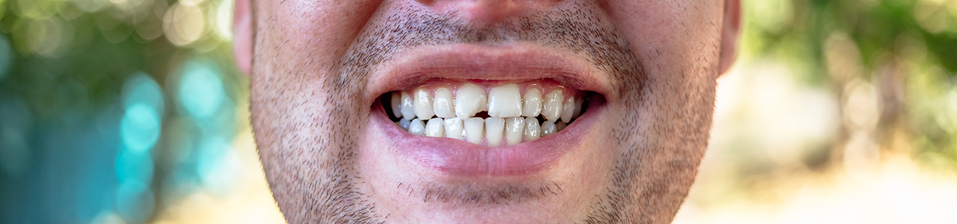 Close up of patient's teeth