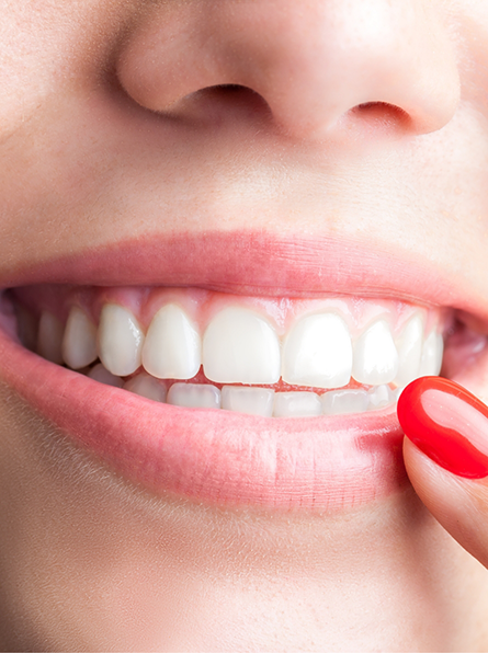 Close up of smile after full mouth reconstruction