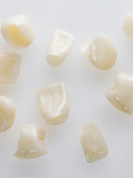 Multiple metal-free restorations on a white surface