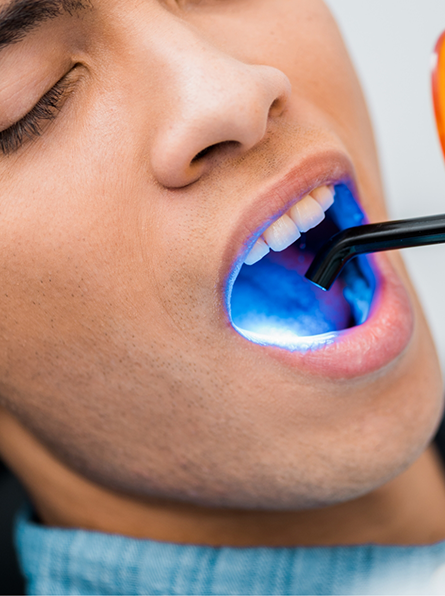 Man receiving dental bonding procedure
