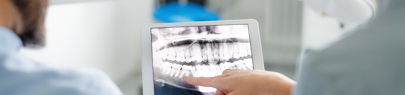 Checking dental X-ray on a tablet